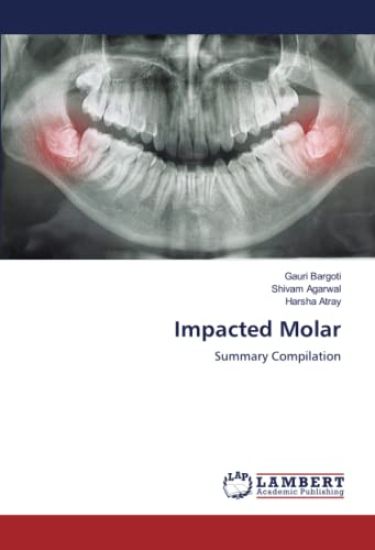Impacted Molar