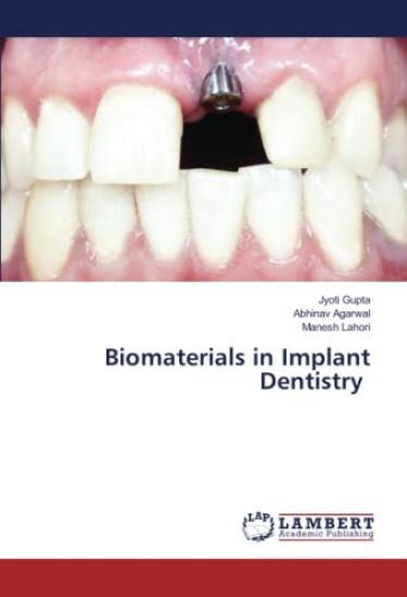 Biomaterials in Implant Dentistry