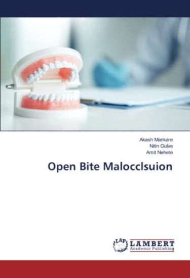 Open Bite Malocclsuion