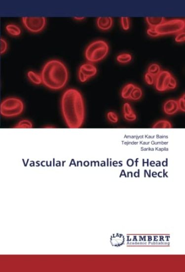 Vascular Anomalies Of Head And Neck
