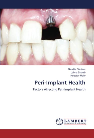 Peri-Implant Health
