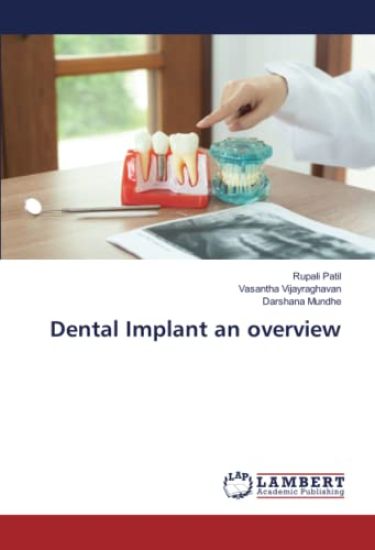 Dental Implant an overview