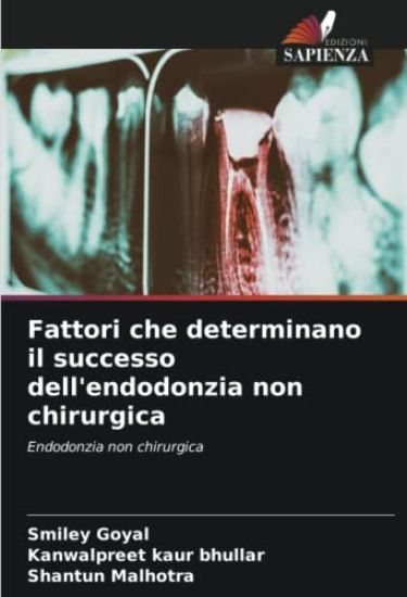 Fattori che determinano il successo dell'endodonzia non chirurgica