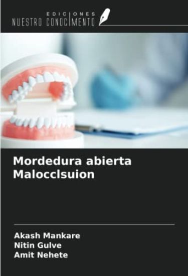Mordedura abierta Malocclsuion