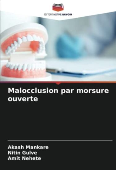 Malocclusion par morsure ouverte
