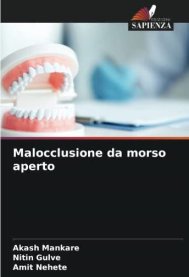 Malocclusione da morso aperto