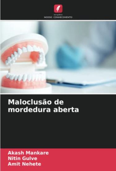 Maloclusão de mordedura aberta