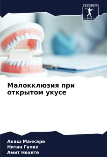 Malokklüziq pri otkrytom ukuse