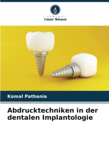 Abdrucktechniken in der dentalen Implantologie – Komal Pathania, kirjan kansikuva