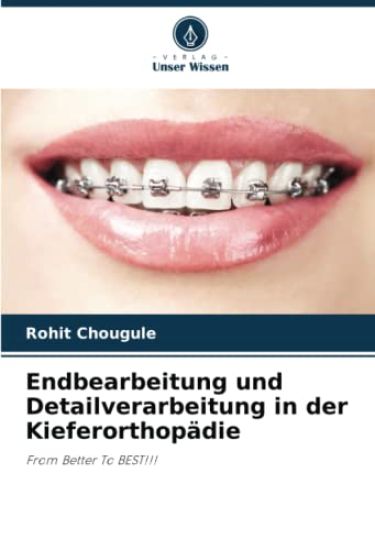 Endbearbeitung und Detailverarbeitung in der Kieferorthopädie