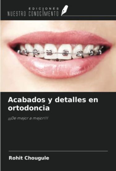 Acabados y detalles en ortodoncia