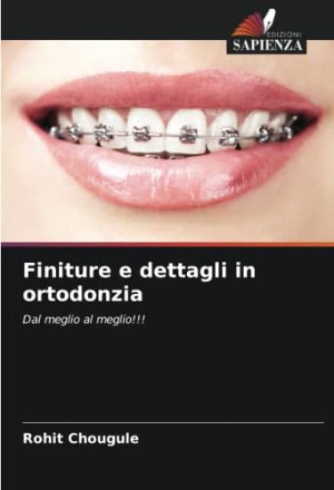 Finiture e dettagli in ortodonzia