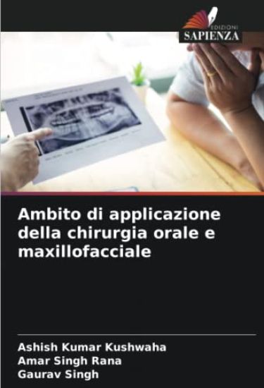 Ambito di applicazione della chirurgia orale e maxillofacciale