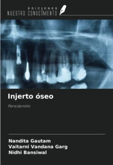 Injerto óseo