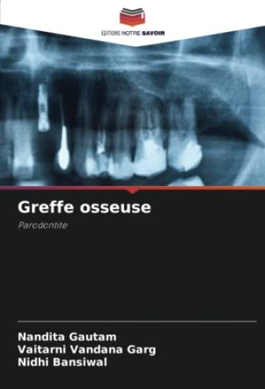 Greffe osseuse