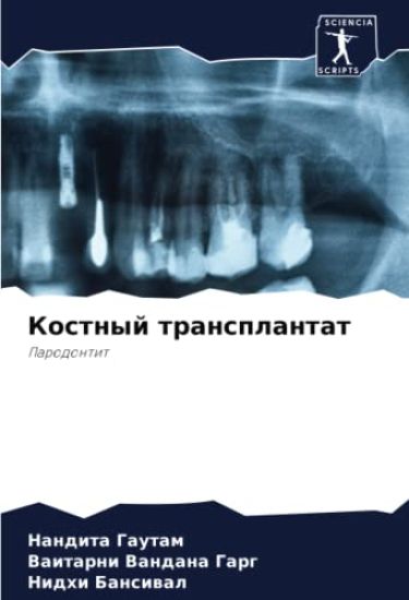 Kostnyj transplantat