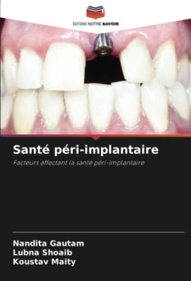 Santé péri-implantaire