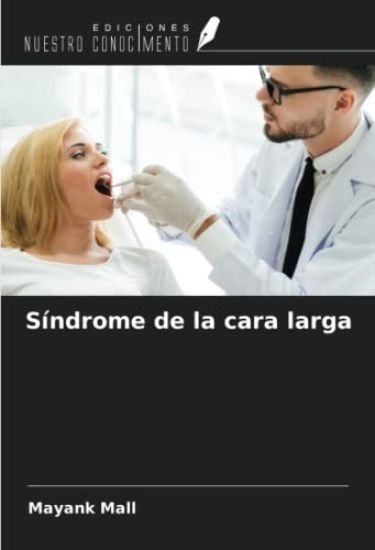 Síndrome de la cara larga