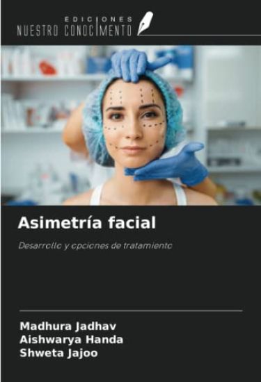 Asimetría facial