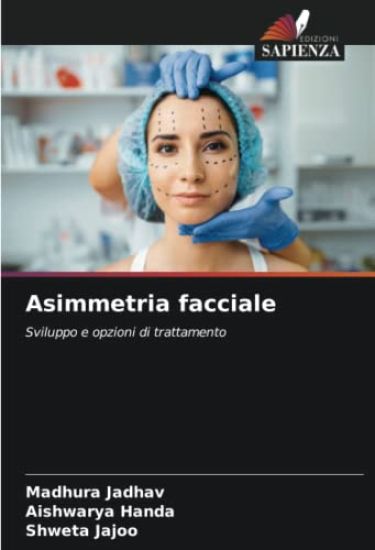 Asimmetria facciale