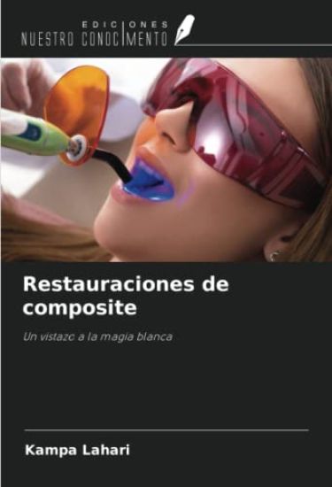Restauraciones de composite