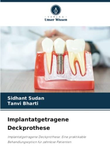 Implantatgetragene Deckprothese