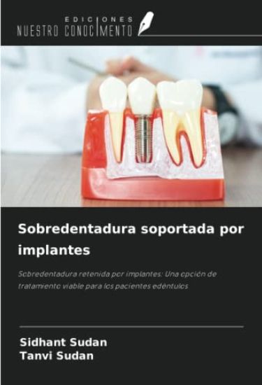 Sobredentadura soportada por implantes