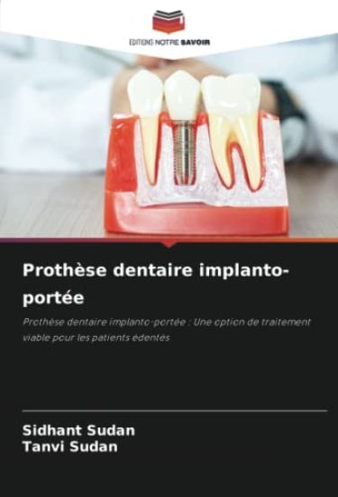 Prothèse dentaire implanto-portée