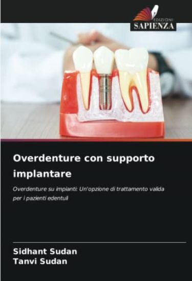 Overdenture con supporto implantare