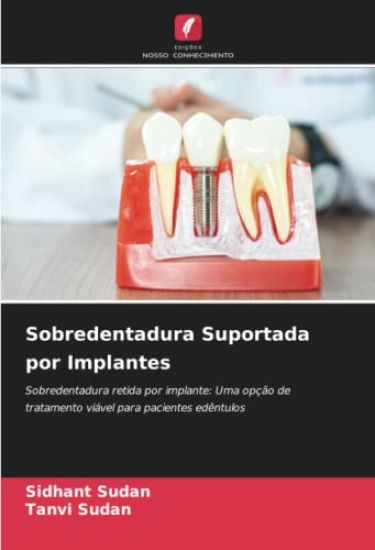 Sobredentadura Suportada por Implantes