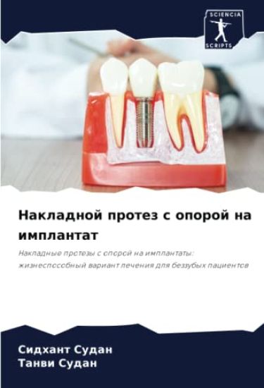 Nakladnoj protez s oporoj na implantat