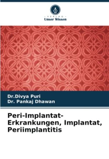 Peri-Implantat-Erkrankungen, Implantat, Periimplantitis