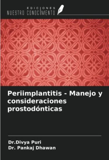 Periimplantitis - Manejo y consideraciones prostodónticas