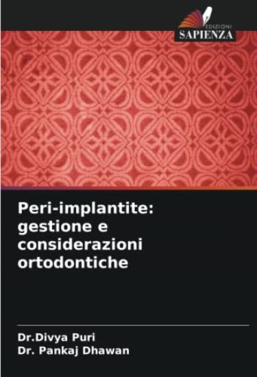 Peri-implantite: gestione e considerazioni ortodontiche