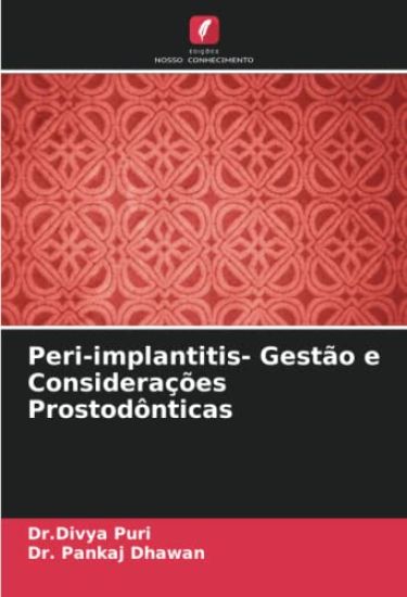 Peri-implantitis- Gestão e Considerações Prostodônticas