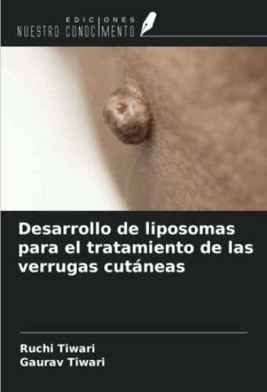 Desarrollo de liposomas para el tratamiento de las verrugas cutáneas