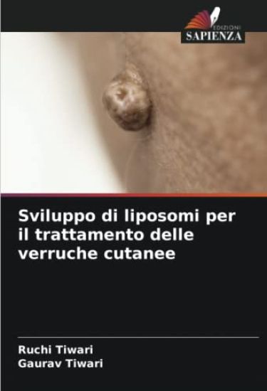 Sviluppo di liposomi per il trattamento delle verruche cutanee