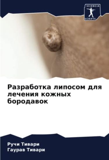 Razrabotka liposom dlq lecheniq kozhnyh borodawok – Ruchi Tiwari, kirjan kansikuva