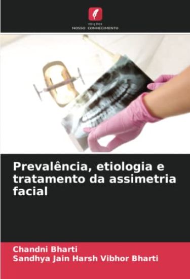 Prevalência, etiologia e tratamento da assimetria facial