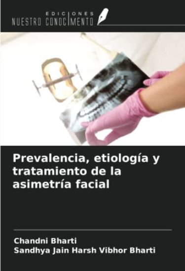 Prevalencia, etiología y tratamiento de la asimetría facial
