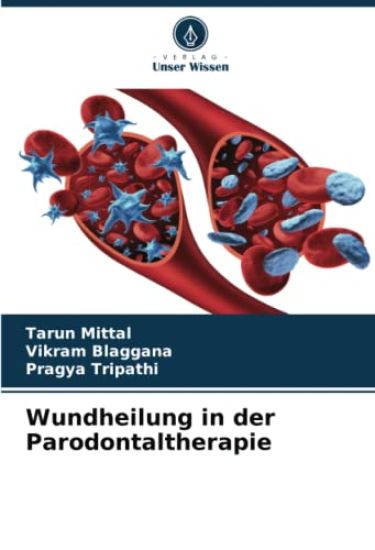 Wundheilung in der Parodontaltherapie