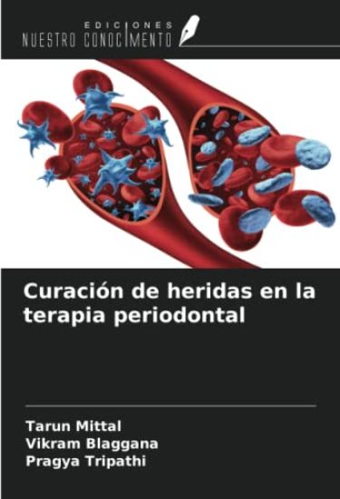 Curación de heridas en la terapia periodontal