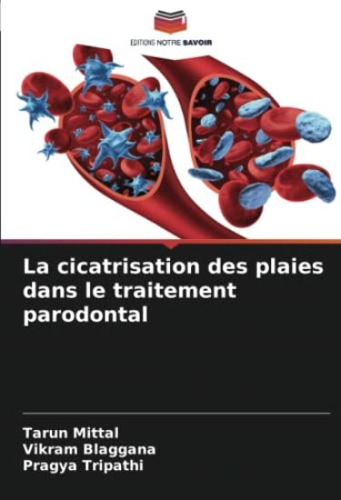 La cicatrisation des plaies dans le traitement parodontal