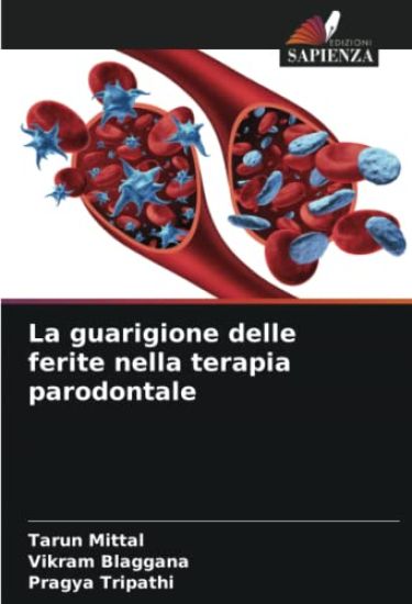 La guarigione delle ferite nella terapia parodontale