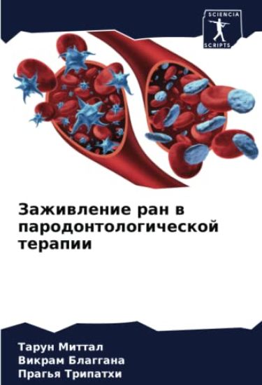 Zazhiwlenie ran w parodontologicheskoj terapii