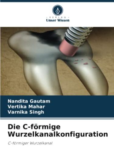Die C-förmige Wurzelkanalkonfiguration