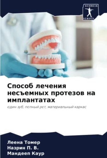 Sposob lecheniq nes#emnyh protezow na implantatah