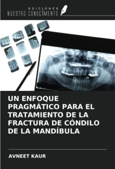 UN ENFOQUE PRAGMÁTICO PARA EL TRATAMIENTO DE LA FRACTURA DE CÓNDILO DE LA MANDÍBULA