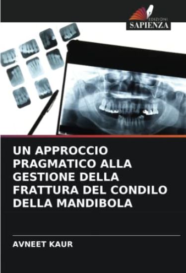 UN APPROCCIO PRAGMATICO ALLA GESTIONE DELLA FRATTURA DEL CONDILO DELLA MANDIBOLA