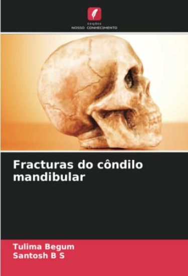 Fracturas do côndilo mandibular